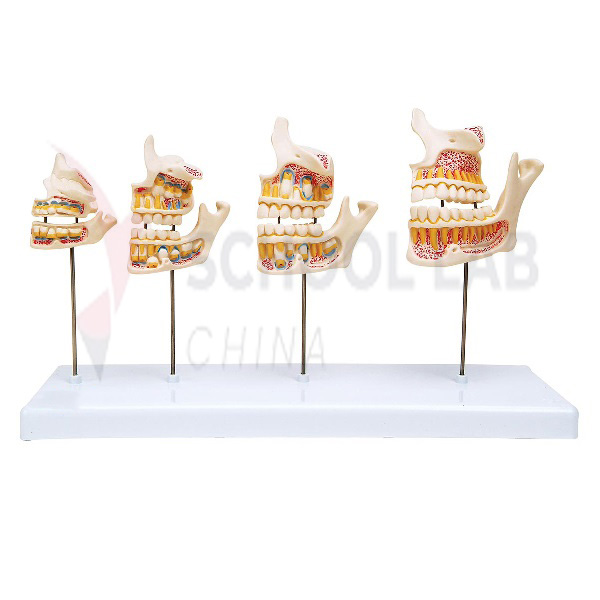 Dentition Development Model