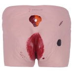 Decubitus Care Model